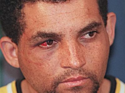 Foto do condenado conhecido como Maníaco do Parque, Francisco de Assis Pereira, close-up de rosto sério com o olho direito avermelhado por lesão, fotografia documental de imprensa em tons neutros